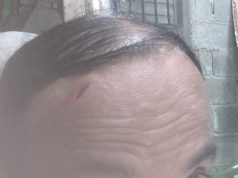 Periodista es golpeado por un antisocial