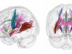 ¿Qué sucede en el cerebro de una mujer embarazada?