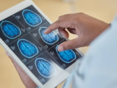 Identifican epicentro envejecimiento en el cerebro