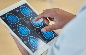 Identifican epicentro envejecimiento en el cerebro