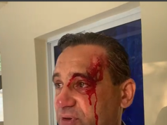 Sacerdote que fuera herido denuncia brutalidad policial