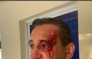 Sacerdote que fuera herido denuncia brutalidad policial