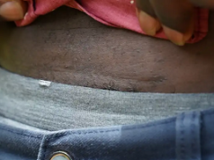 Riñones por dinero: red global de tráfico de órganos