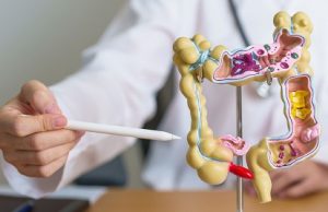 Estudio: Dieta que reduce riesgo cáncer de colon