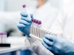 Rusia presenta primeros lotes vacuna contra el cáncer