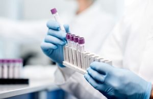 Rusia presenta primeros lotes vacuna contra el cáncer