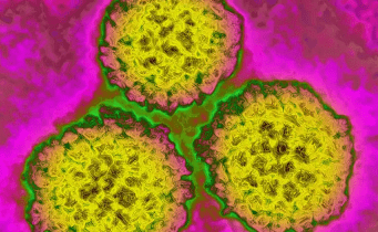 Cómo prevenir el cáncer: un nuevo estudio mapea los riesgos