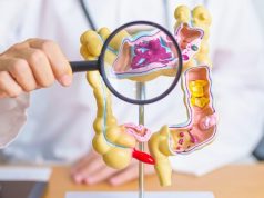 Combinación de dos nutrientes multiplican defensa del colon contra el cáncer